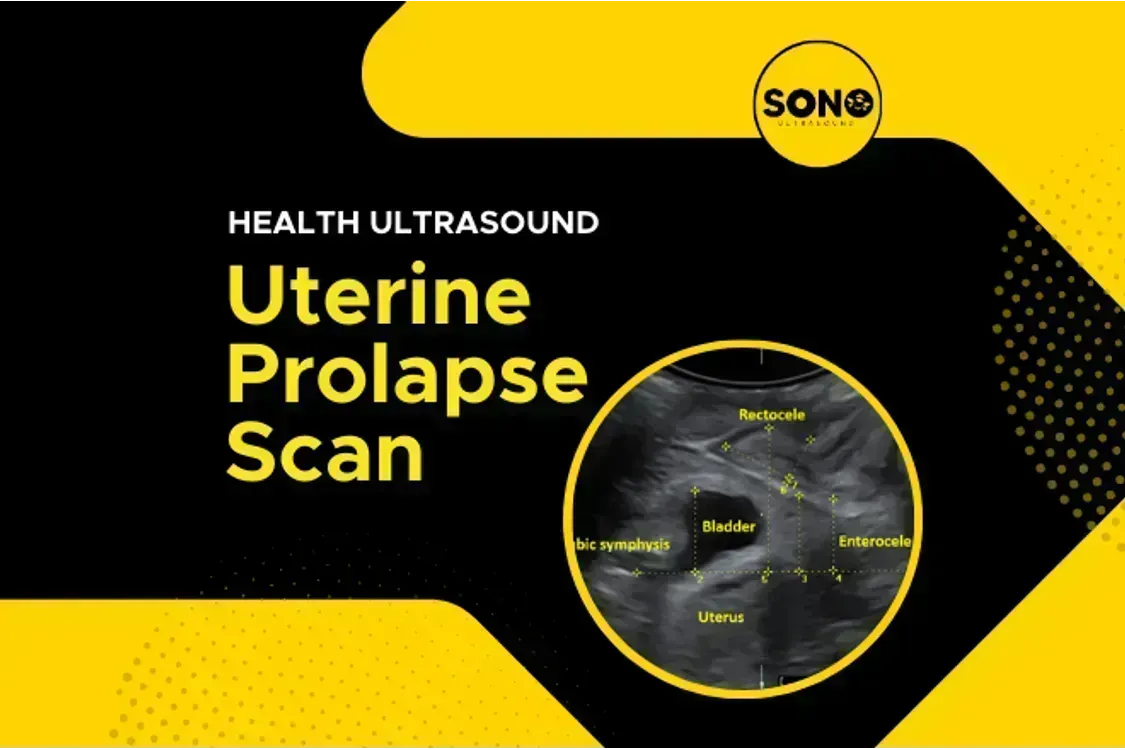 Uterine Prolapse Scan Malaysia (Peranakan Jatuh)